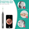 HD Wireless Ear Wax Removal, Ear Cleaner with 1080P Camera