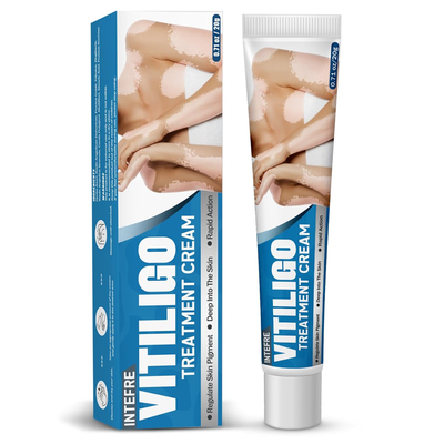 Effective Vitiligo Treatment for Skin Vitiligo, Reduce White Spots & Improve Skin Pigmentation