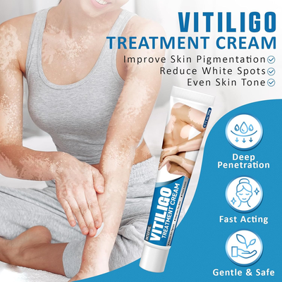 Effective Vitiligo Treatment for Skin Vitiligo, Reduce White Spots & Improve Skin Pigmentation