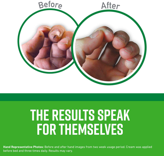 O'Keeffe's Working Hands Hand Cream Value Size, 6.8 ounce Jar, (Pack of 1)