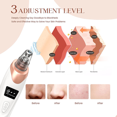  Blackhead Remover Pore Vacuum,Facial Pore Cleaner-5 Suction Power,5 Probes,USB Rechargeable Blackhead Vacuum Kit Electric Acne Extractor Tool 