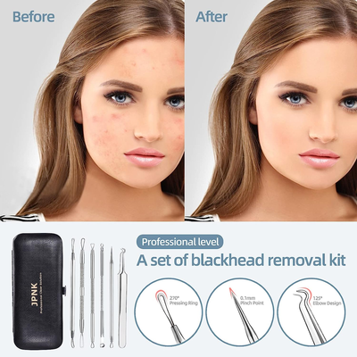 6 Piece Facial Kit with Zit & Blackhead Removing Tools & Case