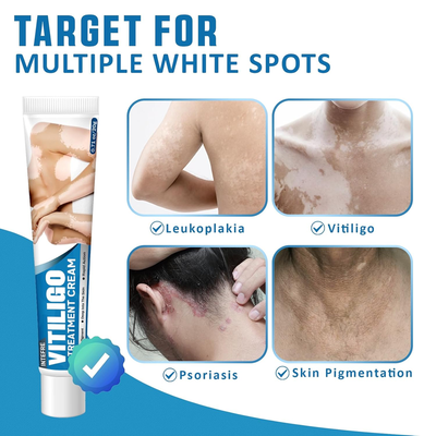 Effective Vitiligo Treatment for Skin Vitiligo, Reduce White Spots & Improve Skin Pigmentation