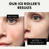 Ice Roller for Face and Body Massage with 2 Heads