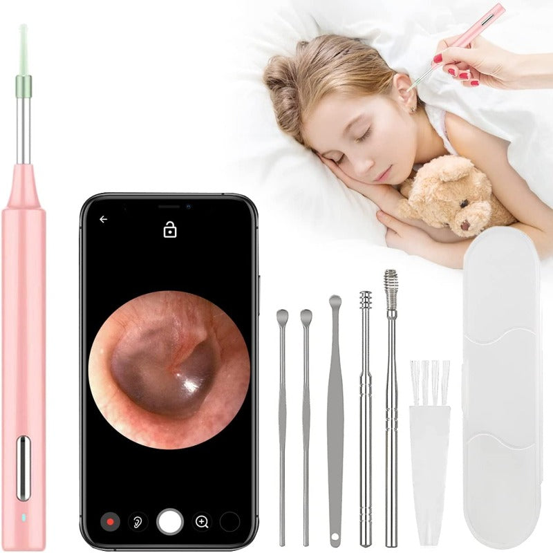 HD Wireless Ear Wax Removal, Ear Cleaner with 1080P Camera