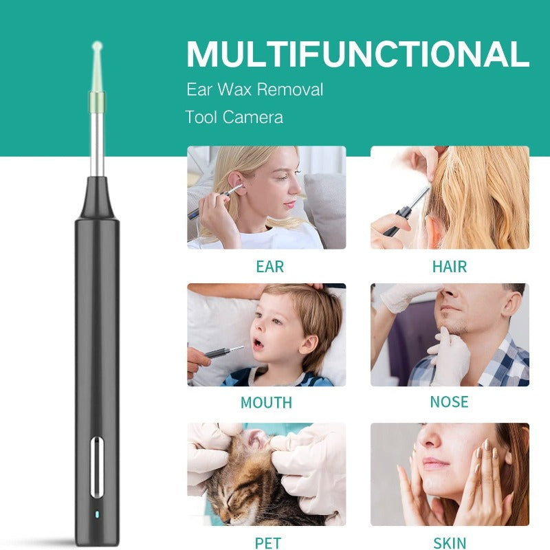 HD Wireless Ear Wax Removal, Ear Cleaner with 1080P Camera