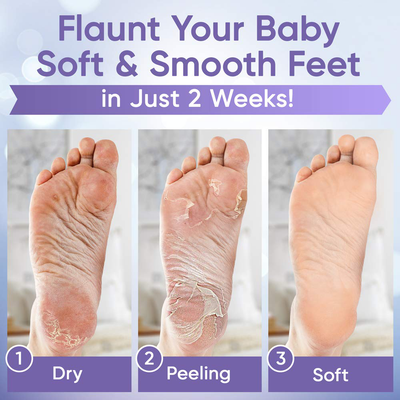 Foot Peel Mask (3 Pairs) - Foot Mask for Baby Feet and Remove Dead Skin - Baby Foot Peel Mask with Lavender and Aloe Vera Gel for Men and Women Feet Peeling Mask