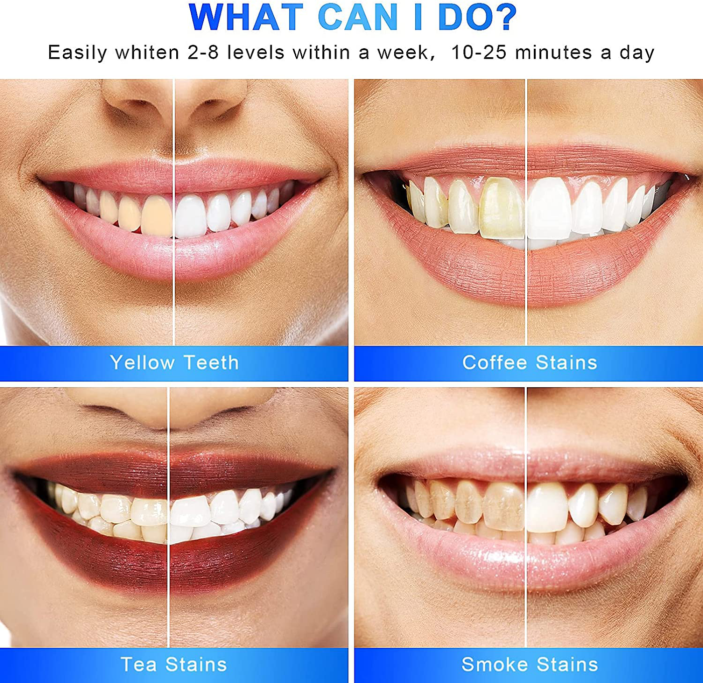 CIMEYOUS Teeth Whitening Led Accelerator Light for Yellow,Coffee,Smoke Teeth,No-Sensitive,Peroxide Gel & (1)2ml Desensitizing Gel,Professional Dental Bleaching Systemel,Easy Whitening in One Week