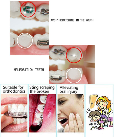 Chargenyang Dental Oral Care Orthodontics Wax with Fruit Smell for Brace Wearers Flavored Gum Protection (6 Boxes)