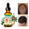 5 Pack Hair Growth Serum, Hair Regrowth Oil Hair Thinning Treatment