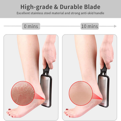 Large Stainless Steel Foot File Callus Remover