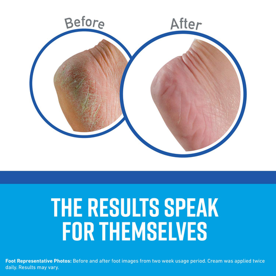 O'Keeffe's Healthy Feet Foot Cream, 3.2 ounce Jar