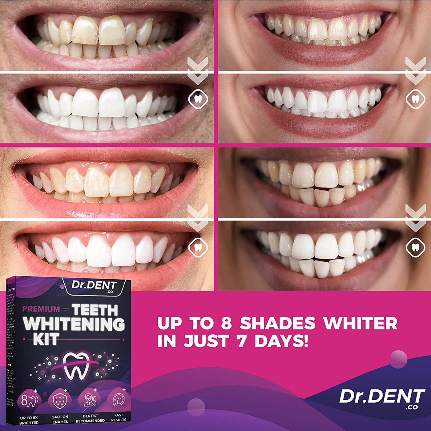 DrDent Premium Teeth Whitening Kit - LED Light, Carbamide Peroxide (3) 5ml Gel Syringes, (1) Remineralization Gel and Tray. Built-in 10-Minute Timer - Restores Your Gleaming White Smile