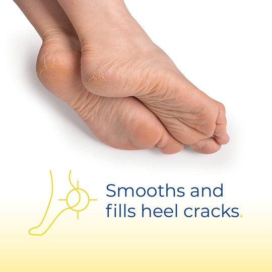 Dr. Scholl's Cracked Heel Repair Balm 2.5oz, with 25% Urea for Dry Cracked Feet, Heals and Moisturizes for Healthy Feet