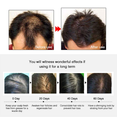 Hair Growth Regeneration Essential Oil Scalp Serum for Men & Women