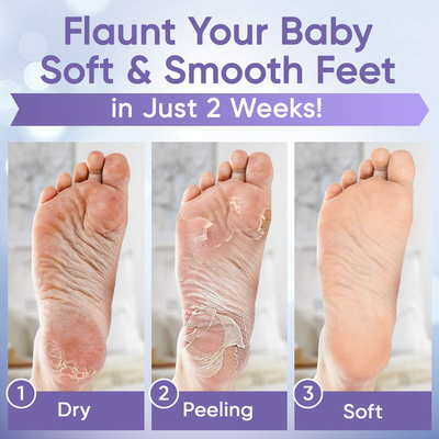 Foot Peel Mask (2 Pairs) - Foot Mask for Baby Feet and Remove Dead Skin - Baby Foot Peel Mask with Lavender and Aloe Vera Gel for Men and Women Feet Peeling Mask Exfoliating