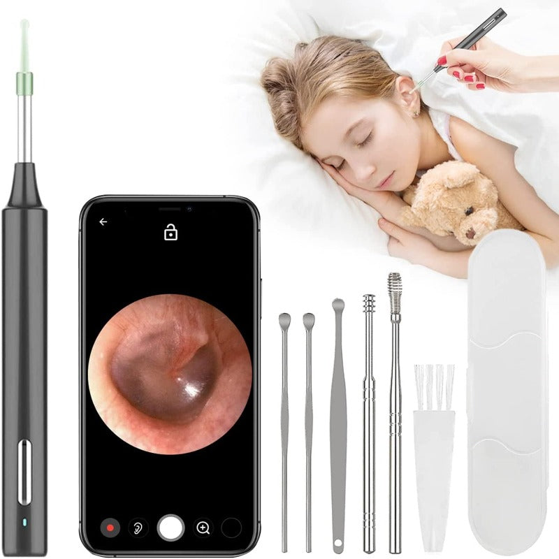 HD Wireless Ear Wax Removal, Ear Cleaner with 1080P Camera